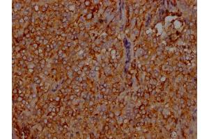 IHC image of ABIN7127599 diluted at 1:100 and staining in paraffin-embedded human adrenal gland tissue performed on a Leica BondTM system. (Recombinant LDLR 抗体)