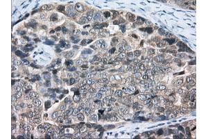 Immunohistochemical staining of paraffin-embedded Human liver tissue using anti-PDE4A mouse monoclonal antibody. (PDE4A 抗体)