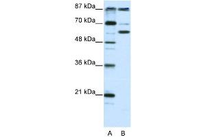 WB Suggested Anti-PCAF Antibody Titration:  2. (KAT2B 抗体  (N-Term))
