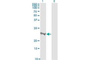 Western Blotting (WB) image for anti-Ras Homolog Gene Family, Member A (RHOA) (AA 1-193) antibody (ABIN559931)