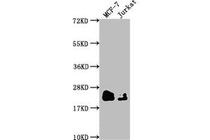 Western Blot Positive WB detected in: MCF-7 whole cell lysate, Jurkat whole cell lysate All lanes: MGMT antibody at 1:1500 Secondary Goat polyclonal to rabbit IgG at 1/50000 dilution Predicted band size: 22 kDa Observed band size: 22 kDa (Recombinant MGMT 抗体)