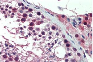 ABIN571037 (10µg/ml) staining of paraffin embedded Human Testis. (PREX1 抗体  (Internal Region))