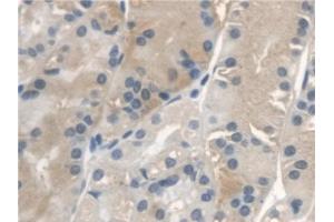 Detection of IGFBP2 in Human Stomach Tissue using Polyclonal Antibody to Insulin Like Growth Factor Binding Protein 2 (IGFBP2)