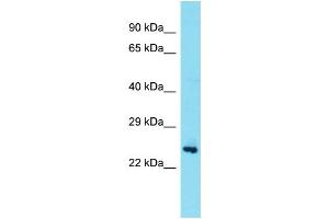 Host: Rabbit Target Name: TEX36 Sample Type: Fetal Brain lysates Antibody Dilution: 1. (TEX36 抗体  (Middle Region))