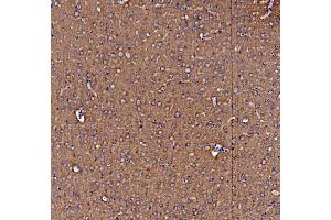 IHC analysis of NSF using anti-NSF antibody (ABIN7601630). (NSF 抗体  (AA 4-636))