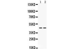 Western blot analysis of Cathepsin K expression in HELA whole cell lysates (lane 1) and 22RV1 whole cell lysates (lane 2). (Cathepsin K 抗体  (AA 115-329))