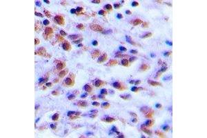 Immunohistochemistry (IHC) image for anti-S100 Calcium Binding Protein A12 (S100A12) antibody (ABIN7308302) (S100A12 抗体)