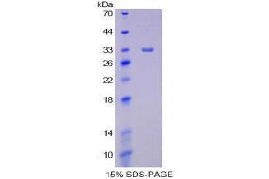 SDS-PAGE (SDS) image for Lipase, Endothelial (LIPG) (AA 203-471) protein (His tag) (ABIN2125692)