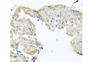 Immunohistochemistry of paraffin-embedded Mouse heart using GPLD1 Polyclonal Antibody at dilution of 1:100 (40x lens). (GPLD1 抗体)