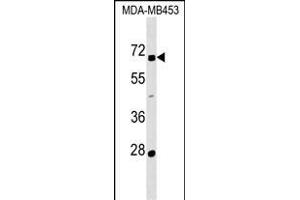 ZN Antibody (N-term) (ABIN1539545 and ABIN2849453) western blot analysis in MDA-M cell line lysates (35 μg/lane). (ZNF565 抗体  (N-Term))