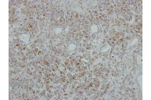 Immunohistochemistry (IHC) image for anti-NADH Dehydrogenase (Ubiquinone) 1 beta Subcomplex, 5, 16kDa (NDUFB5) (C-Term) antibody (ABIN2856830)