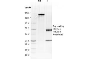 SDS-PAGE Analysis Purified Albumin Mouse Monoclonal Antibody (ALB/2144). (Albumin 抗体)