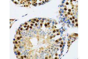 Immunohistochemistry of paraffin-embedded Rat testis using TXNL1 Polyclonal Antibody at dilution of 1:100 (40x lens). (TXNL1 抗体)