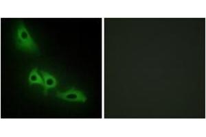 Immunofluorescence analysis of HeLa cells, using GK Antibody. (Glycerol Kinase 抗体  (AA 461-510))