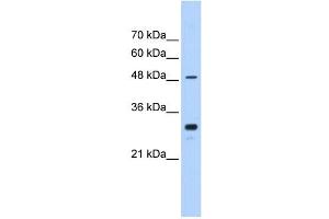 Western Blotting (WB) image for anti-Cytochrome P450, Family 2, Subfamily C, Polypeptide 9 (CYP2C9) (C-Term) antibody (ABIN633894)