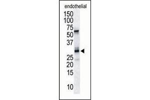 Antibody is used in Western blot to detect RCAN1/DSCR1 in endothelial tissue lysate. (RCAN1 抗体  (C-Term))