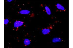 Proximity Ligation Analysis of protein-protein interactions between CAMK2A and SMAD2. (CAMK2A 抗体  (AA 1-478))