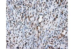 Immunohistochemistry (IHC) image for anti-Fumarylacetoacetate Hydrolase Domain Containing 2A (FAHD2A) antibody (ABIN1498187)