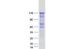Validation with Western Blot