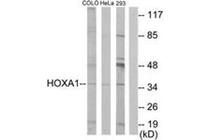 Western blot analysis of extracts from HeLa/COLO/293 cells, using HOXA1 Antibody. (HOXA1 抗体  (AA 171-220))