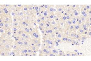 Detection of APOC3 in Mouse Liver Tissue using Monoclonal Antibody to Apolipoprotein C3 (APOC3) (APOC3 抗体  (AA 21-99))