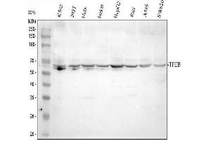 Western blot analysis of TFEB using anti-TFEB antibody (ABIN7602285).