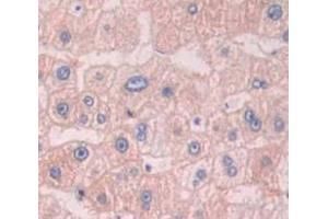 IHC-P analysis of liver tissue, with DAB staining. (APMAP 抗体  (AA 62-289))