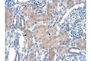 SLA/LP antibody was used for immunohistochemistry at a concentration of 4-8 ug/ml to stain Epithelial cells of renal tubule (arrows) in Human Kidney.