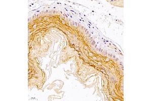 Immunohistochemistry of paraffin embedded mouse esophagus using TR2IT1 (ABIN7075887) at dilution of 1:1500 (400x lens) (TXNRD3NB 抗体)