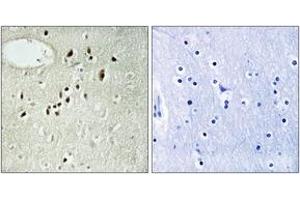 Immunohistochemistry analysis of paraffin-embedded human brain tissue, using EMX2 Antibody. (EMX2 抗体  (AA 91-140))