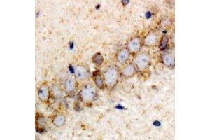 Immunohistochemical analysis of VPS37A staining in rat brain formalin fixed paraffin embedded tissue section. (VPS37A 抗体)