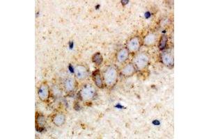 Immunohistochemical analysis of VPS37A staining in rat brain formalin fixed paraffin embedded tissue section.
