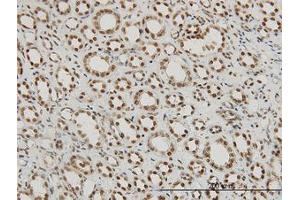 Image no. 5 for anti-Regulation of Nuclear Pre-mRNA Domain Containing 1A (RPRD1A) (AA 76-171) antibody (ABIN466219) (RPRD1A 抗体  (AA 76-171))