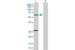 Western Blot analysis of SOCS4 expression in transfected 293T cell line by SOCS4 MaxPab polyclonal antibody. (SOCS4 抗体  (AA 1-440))