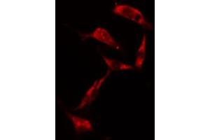ABIN6274203 staining NIH-3T3 cells by IF/ICC. (RPS6KB1 抗体  (C-Term))