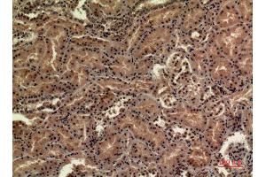 Immunohistochemistry (IHC) analysis of paraffin-embedded Human Kidney, antibody was diluted at 1:100.