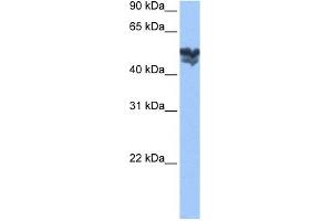 WASF3 antibody used at 1 ug/ml to detect target protein.