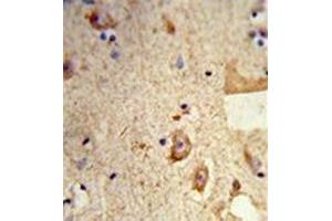 Formalin-fixed and paraffin-embedded human brain tissue reacted with Destrin Antibody , which was peroxidase-conjugated to the secondary antibody, followed by DAB staining. (Destrin 抗体  (Middle Region))