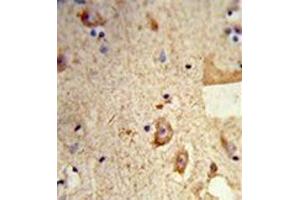Formalin-fixed and paraffin-embedded human brain tissue reacted with Destrin Antibody , which was peroxidase-conjugated to the secondary antibody, followed by DAB staining. (Destrin 抗体  (Middle Region))