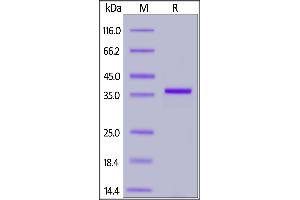 SARS-CoV-2 Papain-like Protease, His Tag on SDS-PAGE under reducing (R) condition. (SARS-CoV-2 NSP3 Protein (His tag))