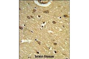 Formalin-fixed and paraffin-embedded human brain tissue reacted with UB Antibody (N-term), which was peroxidase-conjugated to the secondary antibody, followed by DAB staining. (UBAP1 抗体  (N-Term))