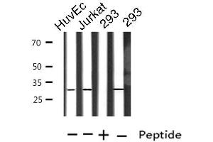 Western blot analysis of extracts from HuvEc/Jurkat/293 cells, using TOLLIP antibody. (TOLLIP 抗体  (Internal Region))