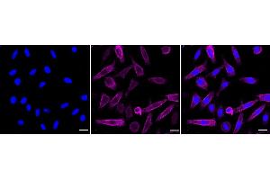Immunocytochemical staining of Hela cells with Moesin antibody (ABIN7799482), 1:1,000). (Recombinant Moesin 抗体)