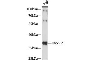 Western blot analysis of extracts of Raji cells, using R antibody (ABIN7269859) at 1:1000 dilution. (RASSF2 抗体  (AA 70-160))