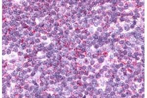 Anti-CCR9 antibody  ABIN1048405 IHC staining of human thymus, lymphocytes. (CCR9 抗体  (Cytoplasmic Domain))