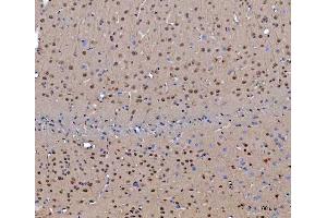 IHC analysis of CEP250 using anti-CEP250 antibody (ABIN7602053). (CEP250 抗体  (AA 563-853))