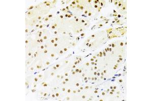 Immunohistochemistry (IHC) image for anti-Recombination Signal Binding Protein For Immunoglobulin kappa J Region (RBPJ) (AA 1-260) antibody (ABIN6146805)