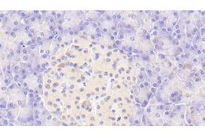Detection of CASP9 in Human Pancreas Tissue using Polyclonal Antibody to Caspase 9 (CASP9) (Caspase 9 抗体  (AA 331-416))