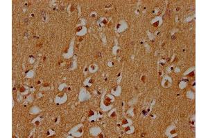 IHC image of ABIN7171265 diluted at 1:300 and staining in paraffin-embedded human brain tissue performed on a Leica BondTM system. (STXBP5 抗体  (AA 515-610))