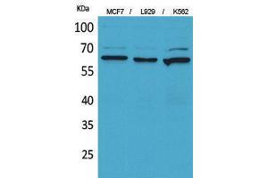 Western Blotting (WB) image for anti-5'-Nucleotidase, Ecto (CD73) (NT5E) (Internal Region) antibody (ABIN3178285) (CD73 抗体  (Internal Region))